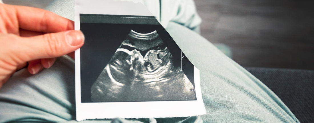 Mother holding sonography image of a baby in belly