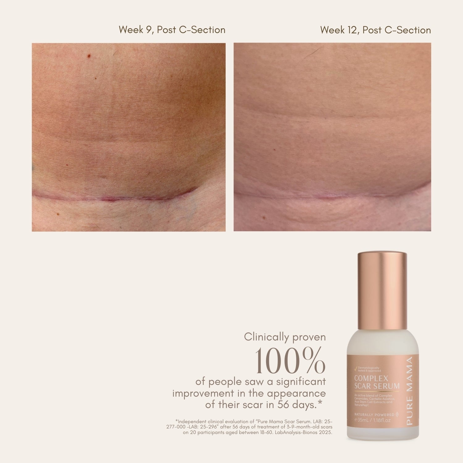 Complex Scar Serum - Pure Mama