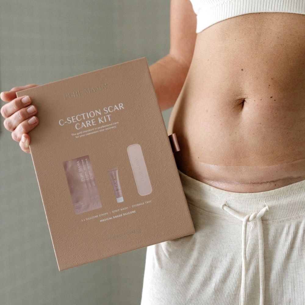 C-Section Kit - Pure Mama