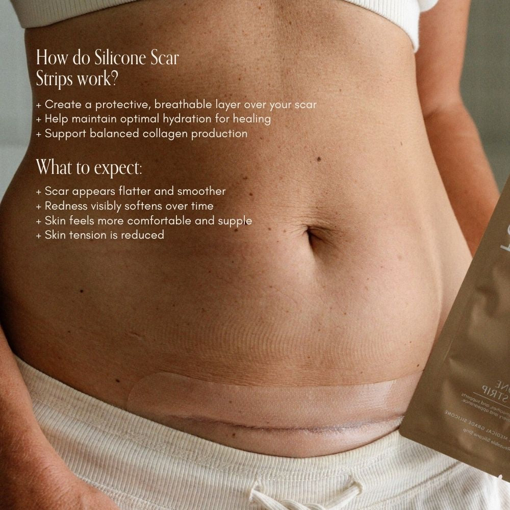 C-Section Kit - Pure Mama