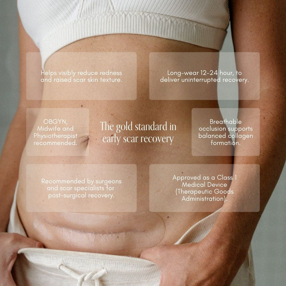 C-Section Kit - Pure Mama