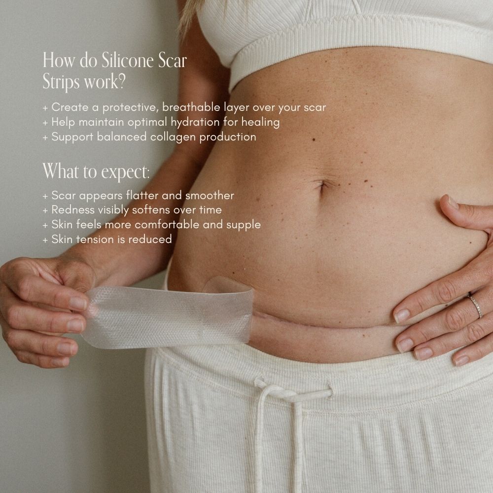 Silicone Strips 1pk - Pure Mama