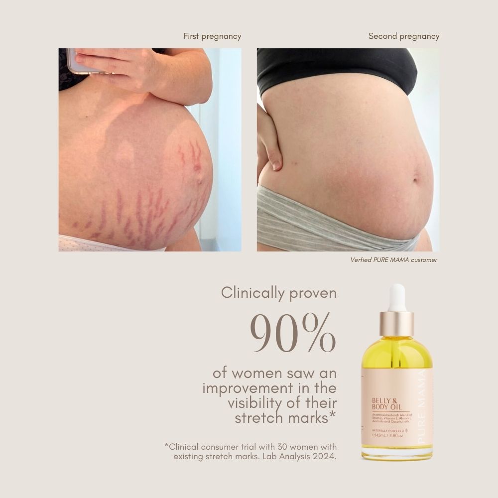 Belly & Body Oil - 145ml 145ml - Pure Mama