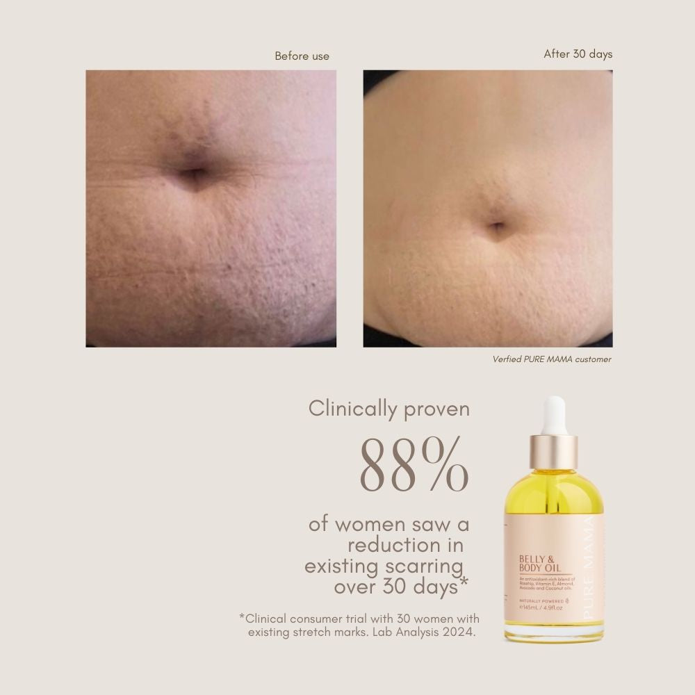Belly & Body Oil - 145ml 145ml - Pure Mama