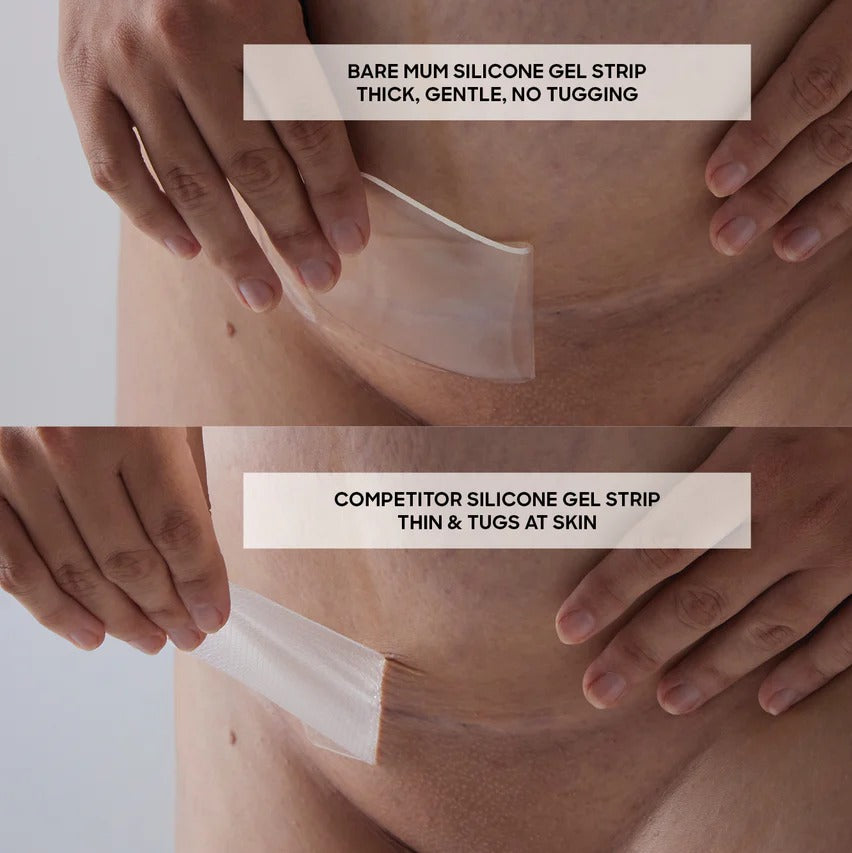 Comparison of postpartum gel strips 